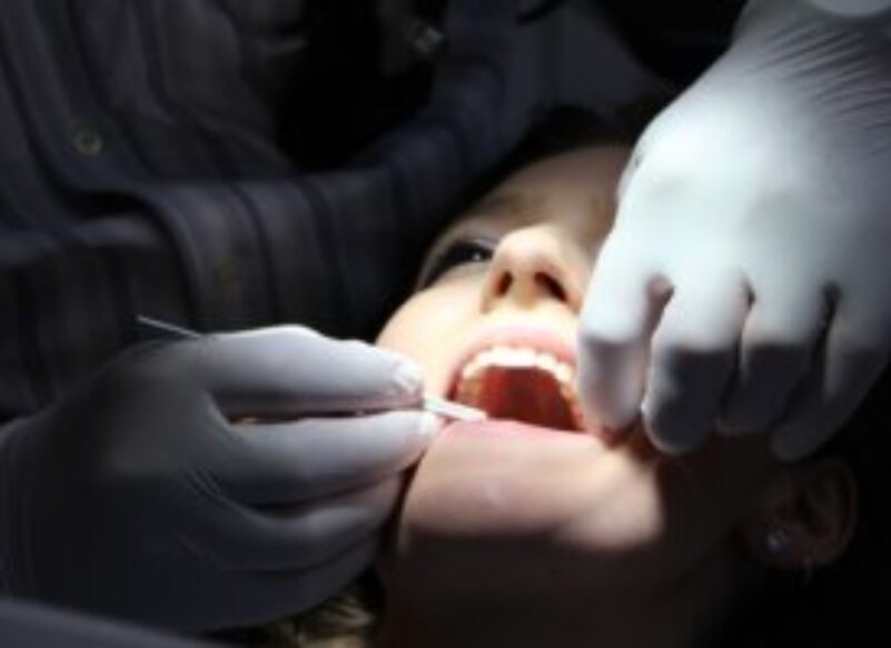 dental crown procedure