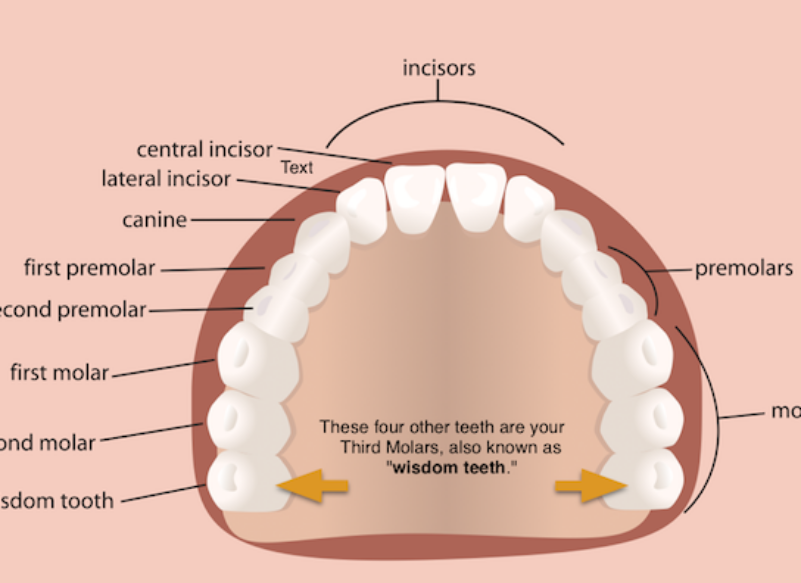 blog thumb - Hove Dental Clinic