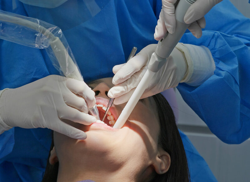 photo of a woman undergoing dental scaling