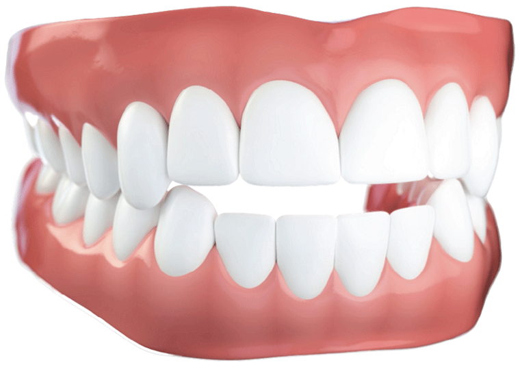 invisalign before after