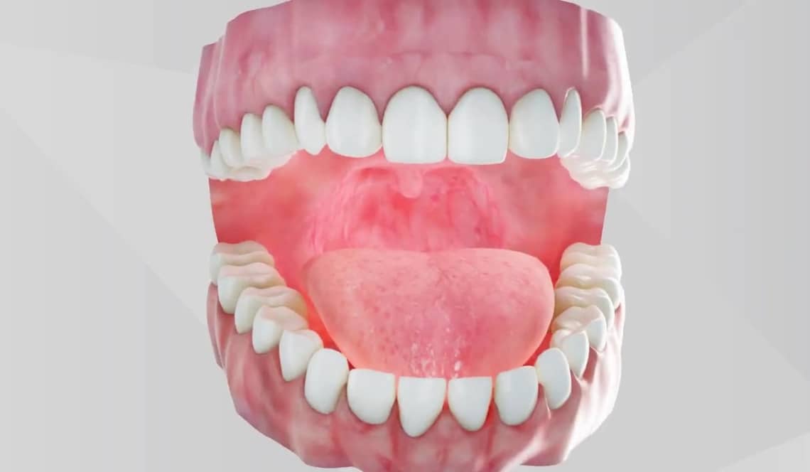 Treatment Preview Image