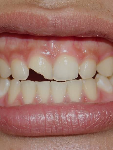 Treatments Image - Hove Dental Clinic
