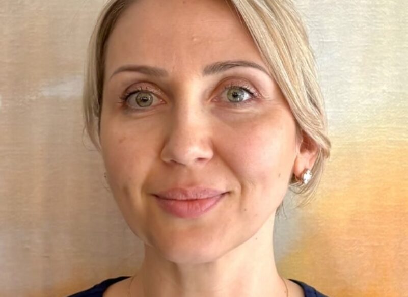 blog thumb - Hove Dental Clinic